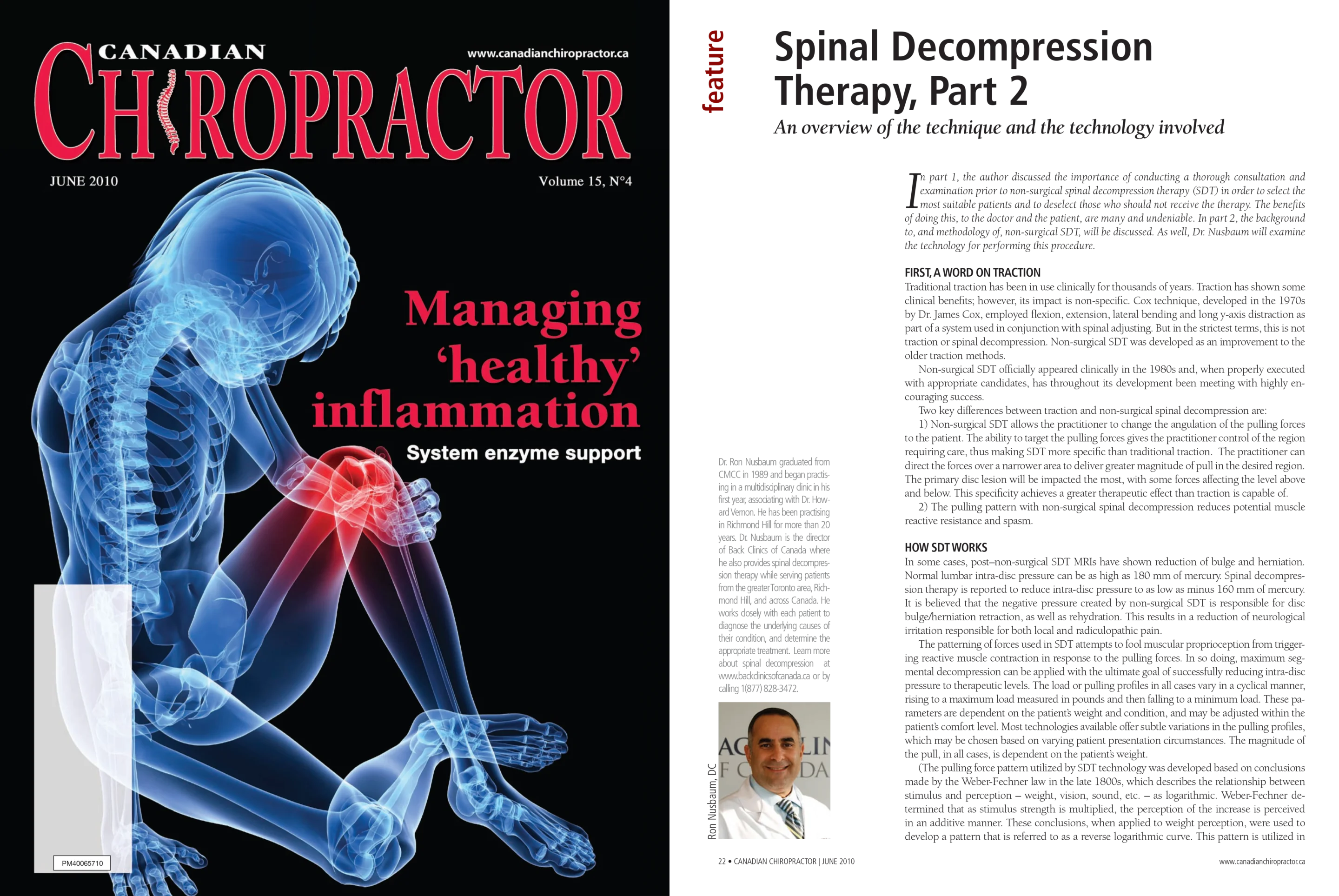 Spinal Decompression Therapy, Part 2 Spinal Decompression Therapy, Part 2