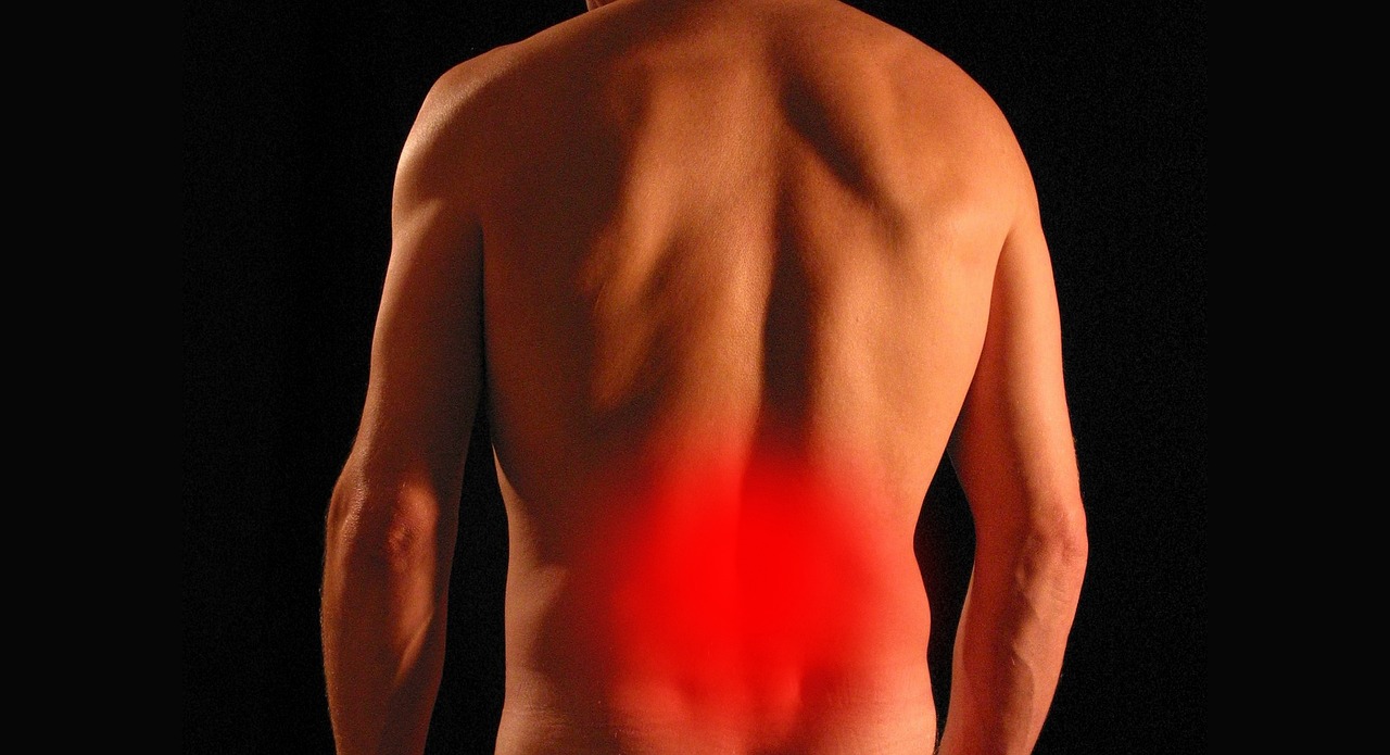 sciatica Learn About Sciatica